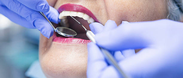 Best Emergency Treatment for Toothache in Ridgecrest, FL